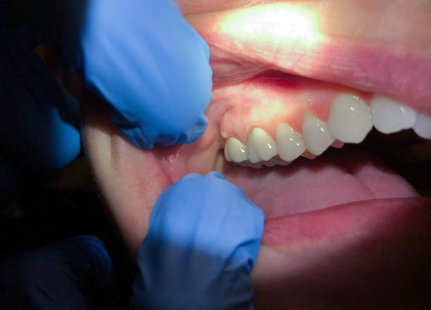 Emergency Gum Pain Relief in TN